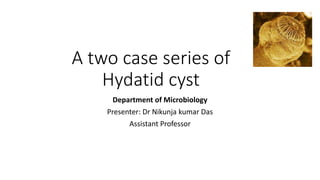 A two case series of
Hydatid cyst
Department of Microbiology
Presenter: Dr Nikunja kumar Das
Assistant Professor
 