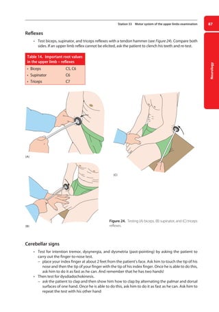 Neurology
87
Station 33 Motor system of the upper limbs examination
Reflexes
• Test biceps, supinator, and triceps reflexes with a tendon hammer (see Figure 24). Compare both
sides. If an upper limb reflex cannot be elicited, ask the patient to clench his teeth and re-test.
Table 14. Important root values
in the upper limb – reflexes
• Biceps C5, C6
• Supinator C6
• Triceps C7
Figure 24. Testing (A) biceps, (B) supinator, and (C) triceps
reflexes.
Cerebellar signs
• Test for intention tremor, dysynergia, and dysmetria (past-pointing) by asking the patient to
carry out the finger-to-nose test.
–
– place your index finger at about 2 feet from the patient’s face. Ask him to touch the tip of his
nose and then the tip of your finger with the tip of his index finger. Once he is able to do this,
ask him to do it as fast as he can. And remember that he has two hands!
• Then test for dysdiadochokinesis.
–
– ask the patient to clap and then show him how to clap by alternating the palmar and dorsal
surfaces of one hand. Once he is able to do this, ask him to do it as fast as he can. Ask him to
repeat the test with his other hand
(A)
(B)
(C)
(A)
(B)
(C)
04-OCSEs-Neurology_5e ccp.indd 87 19/03/2015 12:34
 