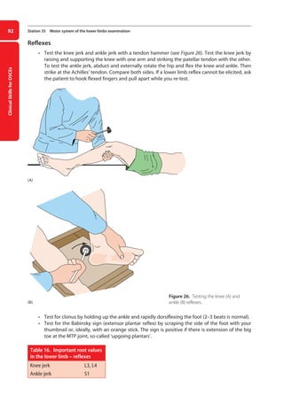 Clinical
Skills
for
OSCEs
92 Station 35 Motor system of the lower limbs examination
Reflexes
• Test the knee jerk and ankle jerk with a tendon hammer (see Figure 26). Test the knee jerk by
raising and supporting the knee with one arm and striking the patellar tendon with the other.
To test the ankle jerk, abduct and externally rotate the hip and flex the knee and ankle. Then
strike at the Achilles’ tendon. Compare both sides. If a lower limb reflex cannot be elicited, ask
the patient to hook flexed fingers and pull apart while you re-test.
Figure 26. Testing the knee (A) and
ankle (B) reflexes.
• Test for clonus by holding up the ankle and rapidly dorsiflexing the foot (2–3 beats is normal).
• Test for the Babinsky sign (extensor plantar reflex) by scraping the side of the foot with your
thumbnail or, ideally, with an orange stick. The sign is positive if there is extension of the big
toe at the MTP joint, so-called ‘upgoing plantars’.
Table 16. Important root values
in the lower limb – reflexes
Knee jerk L3, L4
Ankle jerk S1
(A)
(B)
04-OCSEs-Neurology_5e ccp.indd 92 19/03/2015 12:34
 