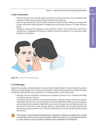 Ophthalmology,
ENT,
and
dermatology
137
Station 51 Vision and the eye examination(including fundoscopy)
4. Eye movements
• Perform the cover test. Ask the patient to fixate on a point and cover one eye. Observe the
movement of the uncovered eye. Repeat the test for the other eye.
• Examine eye movements. Ask the patient to keep his head still and to follow your finger with
his eyes. Ask him to report any pain or double vision at any point. Draw an ‘H’ shape with your
finger.
• Nystagmus. Look out for nystagmus at the extremes of gaze. You can do this as part of eye
movements or separately by fixing the patient’s head and asking him to track your finger
through a cross pattern.
Figure 30. Holding the ophthalmoscope.
5. Fundoscopy
Explain the procedure, mentioning that it may be uncomfortable. Darken the room and ask the patient
to fixate on a distant object (or to ‘look over my shoulder’). State to the examiner that, ideally, the pupils
should have been dilated using a solution of 1% cyclopentolate or 0.5% tropicamide.
• Red reflex. Test the red reflex in each eye from a distance of about 10 cm. An absent red reflex
is usually caused by a cataract.
• Fundoscopy. Use your right eye to examine the patient’s right eye, and your left eye to exam­
ine
the patient’s left eye. If you use your left eye to examine the patient’s right eye, you may appear
more caring than the examiner might like to see. Look at the optic disc, the blood vessels, and
the macula. To find the macula, ask the patient to look directly into the light. Describe any
features according to protocol, e.g. “There are soft exu­dates at 3 o’clock, two disc diameters away
from the disc.”
If the station is examining fundoscopy alone, the patient is likely to be replaced by a model
in which the retinas are very easy to visualise. Before the exam, it is a good idea to look at
as many retinas as you can, both in patients and in textbooks/on the internet.
06-OCSEs-Ophthalmology_5e ccp.indd 137 19/03/2015 07:23
 