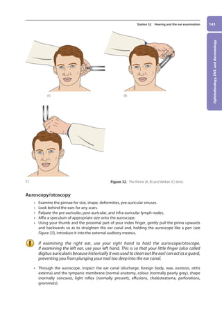 Ophthalmology,
ENT,
and
dermatology
141
Station 52 Hearing and the ear examination
Auroscopy/otoscopy
• Examine the pinnae for size, shape, deformities, pre-auricular sinuses.
• Look behind the ears for any scars.
• Palpate the pre-auricular, post-auricular, and infra-auricular lymph nodes.
• Affix a speculum of appropriate size onto the auroscope.
• Using your thumb and the proximal part of your index finger, gently pull the pinna upwards
and backwards so as to straighten the ear canal and, holding the auroscope like a pen (see
Figure 33), introduce it into the external auditory meatus.
If examining the right ear, use your right hand to hold the auroscope/otoscope.
If examining the left ear, use your left hand. This is so that your little finger (also called
digitus auricularis because historically it was used to clean out the ear) can act as a guard,
preventing you from plunging your tool too deep into the ear canal.
• Through the auroscope, inspect the ear canal (discharge, foreign body, wax, exotosis, otitis
externa) and the tympanic membrane (normal anatomy, colour (normally pearly grey), shape
(normally concave), light reflex (normally present), effusions, cholesteatoma, perforations,
grommets).
(C)
(B)
(A)
Figure 32. The Rinne (A, B) and Weber (C) tests.
06-OCSEs-Ophthalmology_5e ccp.indd 141 19/03/2015 07:23
 