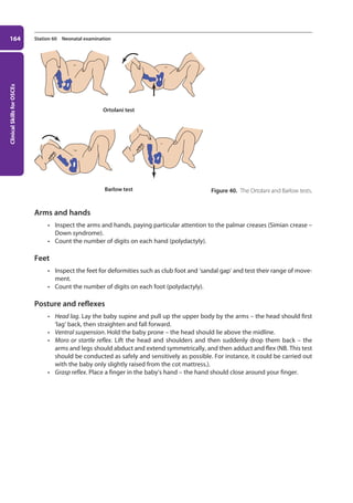 Clinical
Skills
for
OSCEs
164 Station 60 Neonatal examination
Arms and hands
• Inspect the arms and hands, paying particular attention to the palmar creases (Simian crease –
Down syndrome).
• Count the number of digits on each hand (polydactyly).
Feet
• Inspect the feet for deformities such as club foot and ‘sandal gap’ and test their range of move-
ment.
• Count the number of digits on each foot (polydactyly).
Posture and reflexes
• Head lag. Lay the baby supine and pull up the upper body by the arms – the head should first
‘lag’ back, then straighten and fall forward.
• Ventral suspension. Hold the baby prone – the head should lie above the midline.
• Moro or startle reflex. Lift the head and shoulders and then suddenly drop them back – the
arms and legs should abduct and extend symmetrically, and then adduct and flex (NB. This test
should be conducted as safely and sensitively as possible. For instance, it could be carried out
with the baby only slightly raised from the cot mattress.).
• Grasp reflex. Place a finger in the baby’s hand – the hand should close around your finger.
Ortolani test
Barlow test Figure 40. The Ortolani and Barlow tests.
07-OCSEs-Paediatrics__Geriatrics_5e ccp.indd 164 19/03/2015 13:05
 