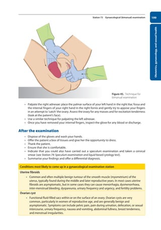 Obstetrics,
gynaecology,
and
sexual
health
199
Station 73 Gynaecological (bimanual) examination
• Palpate the right adnexae: place the palmar surface of your left hand in the right iliac fossa and
the internal fingers of your right hand in the right fornix and gently try to appose your fingers
in an attempt to ‘catch’ the ovary. Assess the ovary for any masses and for excitation tenderness
(look at the patient’s face).
• Use a similar technique for palpating the left adnexae.
• Once you have removed your internal fingers, inspect the glove for any blood or discharge.
After the examination
• Dispose of the gloves and wash your hands.
• Offer the patient a box of tissues and give her the opportunity to dress.
• Thank the patient.
• Ensure that she is comfortable.
• Indicate that you could also have carried out a speculum examination and taken a cervical
smear (see Station 74: Speculum examination and liquid based cytology test).
• Summarise your findings and offer a differential diagnosis.
Conditions most likely to come up in a gynaecological examination station
Uterine fibroids
• Common and often multiple benign tumour of the smooth muscle (myometrium) of the
uterus, typically found during the middle and later reproductive years. In most cases uterine
fibroids are asymptomatic, but in some cases they can cause menorrhagia, dysmenorrhoea,
inter-menstrual bleeding, dyspareunia, urinary frequency and urgency, and fertility problems.
Ovarian cyst
• Functional fluid-filled sacs within or on the surface of an ovary. Ovarian cysts are very
common, particularly in women of reproductive age, and are generally benign and
asymptomatic. Symptoms can include pelvic pain, pain during urination, defecation, or sexual
intercourse, urinary frequency, nausea and vomiting, abdominal fullness, breast tenderness,
and menstrual irregularities.
Figure 45. Technique for
bimanual examination
08-OCSEs-Obstet_Gynae_5e ccp.indd 199 19/03/2015 13:13
 