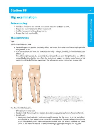 239
Orthopaedics
and
rheumatology
Station 88
Hip examination
Before starting
• Introduce yourself to the patient, and confirm his name and date of birth.
• Explain the examination and obtain his consent.
• Ask him to undress to his undergarments.
• Ensure that he is comfortable.
The examination
Look
Inspect from front and back.
• General inspection: posture, symmetry of legs and pelvis, deformity, muscle wasting (especially
the gluteals), scars.
• Gait (observe from the front and back): note any limp – antalgic, short leg, or Trendelenberg (see
Station 37).
• Trendelenberg’s test: ask the patient to stand on each leg in turn, lifting the other one off the
ground by bending it at the knee. Face the patient and support him by the index fingers of his
outstretched hands. The sign is positive if the pelvis drops on the non-weight bearing side.
Ask the patient to lie supine.
• Skin: colour, sinuses, scars.
• Position: limb shortening, limb rotation, abduction or adduction deformity, flexion ­
deformity.
• Limb length.
–
– to measure true leg length, position the pelvis so that the iliac crests lie in the same hori-
zontal plane, at right angles to the trunk (this is not possible if there is a fixed abduction or
adduction deformity) and then measure the distance from the anterior superior iliac spine
(ASIS) to the medial malleolus. True leg shortening suggests pathology of the hip joint
Figure 53. Negative (left) and positive Trendelenberg’s test.
A positive Trendelenberg’s test suggests weakness of the
abduction of the weight-bearing hip, and hence a problem in
that hip.
09-OCSEs-Orthopaedics_5e ccp.indd 239 19/03/2015 07:45
 