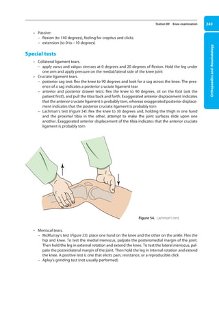 Orthopaedics
and
rheumatology
243
Station 89 Knee examination
• Passive:
– flexion (to 140 degrees), feeling for crepitus and clicks
– extension (to 0 to -10 degrees)
Special tests
• Collateral ligament tears.
– apply varus and valgus stresses at 0 degrees and 20 degrees of flexion. Hold the leg under
one arm and apply pressure on the medial/lateral side of the knee joint
• Cruciate ligament tears.
– posterior sag test: flex the knee to 90 degrees and look for a sag across the knee. The pres-
ence of a sag indicates a posterior cruciate ligament tear
– anterior and posterior drawer tests: flex the knee to 90 degrees, sit on the foot (ask the
patient first!), and pull the tibia back and forth. Exaggerated anterior displacement indicates
that the anterior cruciate ligament is probably torn, whereas exaggerated posterior displace-
ment indicates that the posterior cruciate ligament is probably torn
– Lachman’s test (Figure 54): flex the knee to 30 degrees and, holding the thigh in one hand
and the proximal tibia in the other, attempt to make the joint surfaces slide upon one
another. Exaggerated anterior displacement of the tibia indicates that the anterior cruciate
ligament is probably torn
• Meniscal tears.
– McMurray’s test (Figure 55): place one hand on the knee and the other on the ankle. Flex the
hip and knee. To test the medial meniscus, palpate the posteromedial margin of the joint.
Then hold the leg in external rotation and extend the knee. To test the lateral meniscus, pal-
pate the posterolateral margin of the joint. Then hold the leg in internal rotation and extend
the knee. A positive test is one that elicits pain, resistance, or a reproducible click
– Apley’s grinding test (not usually performed)
Figure 54. Lachman’s test.
09-OCSEs-Orthopaedics_5e ccp.indd 243 19/03/2015 07:45
 