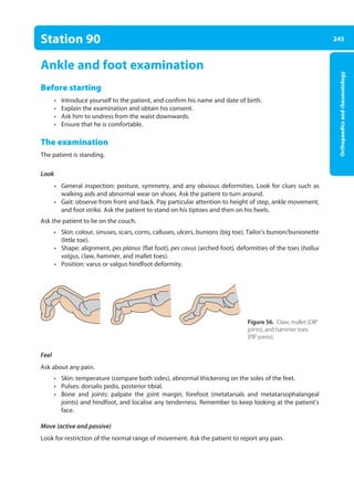 245
Orthopaedics
and
rheumatology
Station 90
Ankle and foot examination
Before starting
• Introduce yourself to the patient, and confirm his name and date of birth.
• Explain the examination and obtain his consent.
• Ask him to undress from the waist downwards.
• Ensure that he is comfortable.
The examination
The patient is standing.
Look
• General inspection: posture, symmetry, and any obvious deformities. Look for clues such as
walking aids and abnormal wear on shoes. Ask the patient to turn around.
• Gait: observe from front and back. Pay particular attention to height of step, ankle movement,
and foot strike. Ask the patient to stand on his tiptoes and then on his heels.
Ask the patient to lie on the couch.
• Skin: colour, sinuses, scars, corns, calluses, ulcers, bunions (big toe), Tailor’s bunion/bunionette
(little toe).
• Shape: alignment, pes planus (flat foot), pes cavus (arched foot), deformities of the toes (hallux
valgus, claw, hammer, and mallet toes).
• Position: varus or valgus hindfoot deformity.
Feel
Ask about any pain.
• Skin: temperature (compare both sides), abnormal thickening on the soles of the feet.
• Pulses: dorsalis pedis, posterior tibial.
• Bone and joints: palpate the joint margin, forefoot (metatarsals and metatarsophalangeal
joints) and hindfoot, and localise any tenderness. Remember to keep looking at the patient’s
face.
Move (active and passive)
Look for restriction of the normal range of movement. Ask the patient to report any pain.
Figure 56. Claw, mallet (DIP
joints), and hammer toes
(PIP joints).
09-OCSEs-Orthopaedics_5e ccp.indd 245 19/03/2015 07:45
 