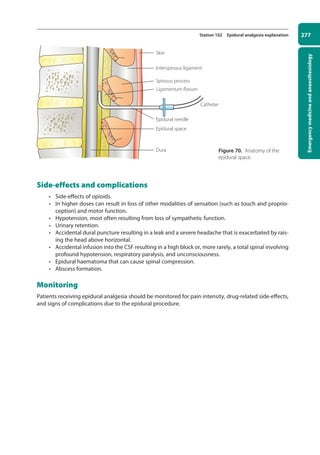 Emergency
medicine
and
anaesthesiology
277
Station 102 Epidural analgesia explanation
Side-effects and complications
• Side-effects of opioids.
• In higher doses can result in loss of other modalities of sensation (such as touch and proprio-
ception) and motor function.
• Hypotension, most often resulting from loss of sympathetic function.
• Urinary retention.
• Accidental dural puncture resulting in a leak and a severe headache that is exacerbated by rais-
ing the head above horizontal.
• Accidental infusion into the CSF resulting in a high block or, more rarely, a total spinal involving
profound hypotension, respiratory paralysis, and unconsciousness.
• Epidural haematoma that can cause spinal compression.
• Abscess formation.
Monitoring
Patients receiving epidural analgesia should be monitored for pain intensity, drug-related side-effects,
and signs of complications due to the epidural procedure.
Dura
Epidural space
Skin
Interspinous ligament
Spinous process
Ligamentum flavum
Epidural needle
Catheter
Figure 70. Anatomy of the
epidural space.
10-OCSEs-Emergency_Medicine_5e ccp.indd 277 19/03/2015 13:32
 