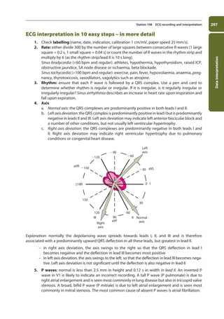 Data
interpretation
297
Station 108 ECG recording and interpretation
ECG interpretation in 10 easy steps – in more detail
1. Check labelling (name, date, indication, calibration 1 cm/mV, paper speed 25 mm/s).
2. Rate: either divide 300 by the number of large squares between consecutive R waves (1 large
square = 0.2 s, 1 small square = 0.04 s) or count the number of R waves in the rhythm strip and
multiply by 6 (as the rhythm strip/lead II is 10 s long).
Sinus bradycardia (60 bpm and regular): athletes, hypothermia, hypothyroidism, raised ICP,
obstructive jaundice, SA node disease or ischaemia, beta blockade.
Sinus tachycardia (100 bpm and regular): exercise, pain, fever, hypovolaemia, anaemia, preg-
nancy, thyrotoxicosis, vasodilators, vagolytics such as atropine.
3. Rhythm: ensure that each P wave is followed by a QRS complex. Use a pen and card to
determine whether rhythm is regular or irregular. If it is irregular, is it regularly irregular or
irregularly irregular? Sinus arrhythmia describes an increase in heart rate upon inspiration and
fall upon expiration.
4. Axis
a. Normal axis: the QRS complexes are predominantly positive in both leads I and II.
b. Leftaxisdeviation: the QRS complex is predominantly positive in lead I but is predominantly
negative in leads II and III. Left axis deviation may indicate left anterior fascicular block and
a number of other conditions, but not usually left ventricular hypertrophy.
c. Right axis deviation: the QRS complexes are predominantly negative in both leads I and
II. Right axis deviation may indicate right ventricular hypertrophy due to pulmonary
conditions or congenital heart disease.
120
120 60
150
150
III
aVR
aVL
aVF
Right
axis
Normal
axis
Left
axis
II
30
±180
30
0
60
90
90
I
Explanation: normally the depolarising wave spreads towards leads I, II, and III and is therefore
associated with a predominantly upward QRS deflection in all these leads, but greatest in lead II.
–
– in right axis deviation, the axis swings to the right so that the QRS deflection in lead I
becomes negative and the deflection in lead III becomes most positive
–
– in left axis deviation, the axis swings to the left, so that the deflection in lead III becomes nega-
tive. Left axis deviation is not significant until the deflection is also negative in lead II
5. P waves: normal is less than 2.5 mm in height and 0.12 s in width in lead II. An inverted P
wave in V1 is likely to indicate an incorrect recording. A tall P wave (P pulmonale) is due to
right atrial enlargement and is seen most commonly in lung disease but also in tricuspid valve
stenosis. A broad, bifid P wave (P mitrale) is due to left atrial enlargement and is seen most
commonly in mitral stenosis. The most common cause of absent P waves is atrial fibrillation.
11-OCSEs-Data_interpretation_5e ccp.indd 297 19/03/2015 13:39
 