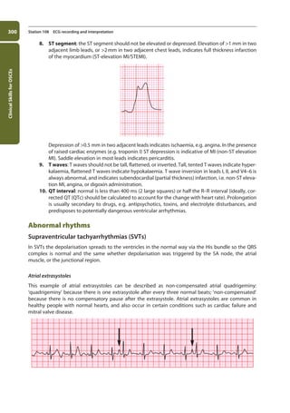 Clinical
Skills
for
OSCEs
300 Station 108 ECG recording and interpretation
8. ST segment: the ST segment should not be elevated or depressed. Elevation of 1 mm in two
adjacent limb leads, or 2mm in two adjacent chest leads, indicates full thickness infarction
of the myocardium (ST-elevation MI/STEMI).
Depression of 0.5 mm in two adjacent leads indicates ischaemia, e.g. angina. In the presence
of raised cardiac enzymes (e.g. troponin I) ST depression is indicative of MI (non-ST elevation
MI). Saddle elevation in most leads indicates pericarditis.
9. T waves: T waves should not be tall, flattened, or inverted. Tall, tented T waves indicate hyper-
kalaemia, flattened T waves indicate hypokalaemia. T wave inversion in leads I, II, and V4–6 is
always abnormal, and indicates subendocardial (partial thickness) infarction, i.e. non-ST eleva-
tion MI, angina, or digoxin administration.
10. QT interval: normal is less than 400 ms (2 large squares) or half the R–R interval (ideally, cor-
rected QT (QTc) should be calculated to account for the change with heart rate). Prolongation
is usually secondary to drugs, e.g. antipsychotics, toxins, and electrolyte disturbances, and
predisposes to potentially dangerous ventricular arrhythmias.
Abnormal rhythms
Supraventricular tachyarrhythmias (SVTs)
In SVTs the depolarisation spreads to the ventricles in the normal way via the His bundle so the QRS
complex is normal and the same whether depolarisation was triggered by the SA node, the atrial
muscle, or the junctional region.
Atrial extrasystoles
This example of atrial extrasystoles can be described as non-compensated atrial quadrigeminy:
‘quadrigeminy’ because there is one extrasystole after every three normal beats; ‘non-compensated’
because there is no compensatory pause after the extrasystole. Atrial extrasystoles are common in
healthy people with normal hearts, and also occur in certain conditions such as cardiac failure and
mitral valve disease.
11-OCSEs-Data_interpretation_5e ccp.indd 300 19/03/2015 13:39
 