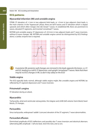 Clinical
Skills
for
OSCEs
304 Station 108 ECG recording and interpretation
ECG patterns
Myocardial infarction (MI) and unstable angina
STEMI: ST elevation of 1mm in two adjacent limb leads, or 2mm in two adjacent chest leads, is
the main criterion. In the ‘hyperacute’ phase, there are tall R waves and ST elevation which is sloped
upwards and which often merges into tall, broad T waves. In established MI, there are prominent Q
waves, elevated ST segments, and inverted ‘arrowhead’ T waves.
NSTEMI and unstable angina: ST depression of 0.5mm in two adjacent leads and T wave inversion,
without Q wave changes. NB. NSTEMI and unstable angina cannot be distinguished by ECG findings
alone; a cardiac enzyme test is required.
In posterior MI, posterior wall changes are mirrored in the leads opposite the lesion, i.e. V1
and V2, leading to a tall R, ST depression, and upright ‘arrowhead’ T waves. Note that there
may be no ECG changes in MI, so don’t rely solely on the ECG!
Stable angina
The ECG typically looks normal, although stable angina might, like unstable angina and NSTEMI, be
reflected by ST segment depression and T wave inversion.
Prinzmetal’s angina
ST elevation during an attack.
Myocarditis
Tachycardia, atrial and ventricular extrasystoles, first degree and LAHB (left anterior hemi-block) heart
blocks, ST changes.
Pericarditis
Sinus tachycardia, widespread ‘saddle’ (concave) elevation of the ST segment, T wave abnormalities.
Pericardial effusion
Diminished amplitude of ECG deflections and possibly also T wave inversion and electrical alternans
(alternating QRS amplitude = tall one beat, short the next, and so on).
11-OCSEs-Data_interpretation_5e ccp.indd 304 19/03/2015 13:39
 