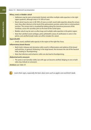 Clinical
Skills
for
OSCEs
314 Station 110 Abdominal X-ray interpretation
Biliary, renal, or bladder calculi
• Gallstones may be seen as laminated, faceted, and often multiple radio-opacities in the right
upper quadrant, although only in 10–20% of cases.
• Renal calculi may be seen in 80–90% of cases as small, round radio-opacities along the urinary
tract; they often obstruct at the level of the pelviureteric junction, pelvic brim or vesicoureteric
junction. The urinary tract is visualised by looking along the transverse processes of the
vertebrae, across the sacroiliac joint to the level of the ischial spine.
• Bladder calculi may be seen as often large and multiple radio-opacities in the pelvic region.
• Note that calcified costal cartilages, pelvic phleboliths (areas of calcification in veins in the
pelvis), and calcified lymph nodes can all be mistaken for calculi.
Appendicolith
• Small, round, calcified radio-opacity in the region of the right Iliac fossa.
Inflammatory bowel disease
• Both Crohn’s disease and ulcerative colitis result in inflammation and oedema of the bowel
wall and thus, in general, thickening. In the large bowel, this increases the size of the haustral
folds, leading to ‘thumbprinting’.
• Note that infection and ischaemic colitis can also lead to thumbprinting.
Abdominal aortic aneurysm
• The aorta is not normally visible, but with age can become calcified. Bulging on one or both
sides may indicate an aneurysm.
Artefacts (see Table 37)
Learn their signs, especially the barn-door ones such as apple-core and bird’s beak.
11-OCSEs-Data_interpretation_5e ccp.indd 314 19/03/2015 13:39
 