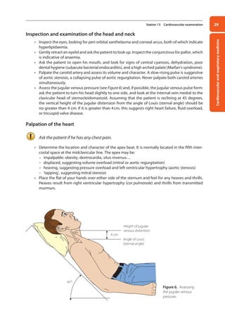 Cardiovascular
and
respiratory
medicine
29
Station 13 Cardiovascular examination
Inspection and examination of the head and neck
• Inspect the eyes, looking for peri-orbital xanthelasma and corneal arcus, both of which indicate
hyperlipidaemia.
• Gently retract an eyelid and ask the patient to look up. Inspect the conjunctivus for pallor, which
is indicative of anaemia.
• Ask the patient to open his mouth, and look for signs of central cyanosis, dehydration, poor
dental hygiene (subacute bacterial endocarditis), and a high arched palate (Marfan’s syndrome).
• Palpate the carotid artery and assess its volume and character. A slow-rising pulse is suggestive
of aortic stenosis, a collapsing pulse of aortic regurgitation. Never palpate both carotid arteries
simultaneously.
• Assess the jugular venous pressure (see Figure 6) and, if possible, the jugular venous pulse form:
ask the patient to turn his head slightly to one side, and look at the internal vein medial to the
clavicular head of sternocleidomastoid. Assuming that the patient is reclining at 45 degrees,
the vertical height of the jugular distension from the angle of Louis (sternal angle) should be
no greater than 4 cm: if it is greater than 4cm, this suggests right heart failure, fluid overload,
or tricuspid valve disease.
Palpation of the heart
Ask the patient if he has any chest pain.
• Determine the location and character of the apex beat. It is normally located in the fifth inter-
costal space at the mid­
clavicular line. The apex may be:
–
– impalpable: obesity, dextrocardia, situs inversus…
–
– displaced, suggesting volume overload (mitral or aortic regurgitation)
–
– heaving, suggesting pressure overload and left ventricular hypertrophy (aortic stenosis)
–
– ‘tapping’, suggesting mitral stenosis
• Place the flat of your hands over either side of the sternum and feel for any heaves and thrills.
Heaves result from right ventricular hypertrophy (cor pulmonale) and thrills from transmitted
murmurs.
45°
Height of jugular
venous distention
Angle of Louis
(sternal angle)
4 cm
Figure 6. Assessing
the jugular venous
pressure.
02-OCSEs-Cardio__Resp_Med_5e ccp.indd 29 18/03/2015 13:21
 