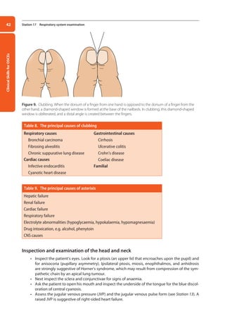Clinical
Skills
for
OSCEs
42 Station 17 Respiratory system examination
Table 8. The principal causes of clubbing
Respiratory causes
Bronchial carcinoma
Fibrosing alveolitis
Chronic suppurative lung disease
Cardiac causes
Infective endocarditis
Cyanotic heart disease
Gastrointestinal causes
Cirrhosis
Ulcerative colitis
Crohn’s disease
Coeliac disease
Familial
Table 9. The principal causes of asterixis
Hepatic failure
Renal failure
Cardiac failure
Respiratory failure
Electrolyte abnormalities (hypoglycaemia, hypokalaemia, hypomagnesaemia)
Drug intoxication, e.g. alcohol, phenytoin
CNS causes
Inspection and examination of the head and neck
• Inspect the patient’s eyes. Look for a ptosis (an upper lid that encroaches upon the pupil) and
for anisocoria (pupillary asymmetry). Ipsilateral ptosis, miosis, enophthalmos, and anhidrosis
are strongly suggestive of Horner’s syndrome, which may result from compression of the sym-
pathetic chain by an apical lung tumour.
• Next inspect the sclera and conjunctivae for signs of anaemia.
• Ask the patient to open his mouth and inspect the underside of the tongue for the blue discol-
oration of central cyanosis.
• Assess the jugular venous pressure (JVP) and the jugular venous pulse form (see Station 13). A
raised JVP is suggestive of right-sided heart failure.
Figure 9. Clubbing. When the dorsum of a finger from one hand is opposed to the dorsum of a finger from the
other hand, a diamond-shaped window is formed at the base of the nailbeds. In clubbing, this diamond-shaped
window is obliterated, and a distal angle is created between the fingers.
02-OCSEs-Cardio__Resp_Med_5e ccp.indd 42 18/03/2015 13:21
 