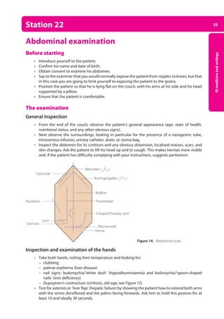 55
GI
medicine
and
urology
Station 22
Abdominal examination
Before starting
• Introduce yourself to the patient.
• Confirm his name and date of birth.
• Obtain consent to examine his abdomen.
• Say to the examiner that you would normally expose the patient from nipples to knees, but that
in this case you are going to limit yourself to exposing the patient to the groins.
• Position the patient so that he is lying flat on the couch, with his arms at his side and his head
supported by a pillow.
• Ensure that the patient is comfortable.
The examination
General inspection
• From the end of the couch, observe the patient’s general appearance (age, state of health,
nutritional status, and any other obvious signs).
• Next observe the surroundings, looking in particular for the presence of a nasogastric tube,
intravenous infusion, urinary catheter, drain, or stoma bag.
• Inspect the abdomen for its contours and any obvious distension, localised masses, scars, and
skin changes. Ask the patient to lift his head up and to cough. This makes hernias more visible
and, if the patient has difficulty complying with your instructions, suggests peritonism.
Inspection and examination of the hands
• Take both hands, noting their temperature and looking for:
–
– clubbing
–
– palmar erythema (liver disease)
–
– nail signs: leukonychia/‘white dash’ (hypoalbuminaemia) and koilonychia/‘spoon-shaped
nails’ (iron deficiency)
–
– Dupuytren’s contracture (cirrhosis, old age; see Figure 15)
• Test for asterixis or ‘liver flap’ (hepatic failure) by showing the patient how to extend both arms
with the wrists dorsiflexed and the palms facing forwards. Ask him to hold this posture for at
least 10 and ideally 30 seconds.
Subcostal
Flank/loin
Lanz
Grid iron
Mercedes ( )
Roof top/gable ( )
Midline
Paramedian
Pfannenstiel
Hernia
J-shaped/’hockey stick’
Figure 14. Abdominal scars.
03-OCSEs-GI_Medicine_and_Urology_5e ccp.indd 55 19/03/2015 12:31
 