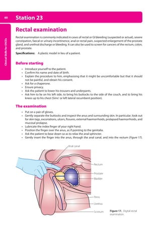 Clinical
Skills
for
OSCEs
60 Station 23
Rectal examination
Rectal examination is commonly indicated in cases of rectal or GI bleeding (suspected or actual), severe
constipation, faecal or urinary incontinence, anal or rectal pain, suspected enlargement of the prostate
gland, and urethral discharge or bleeding. It can also be used to screen for cancers of the rectum, colon,
and prostate.
Specifications: A plastic model in lieu of a patient.
Before starting
• Introduce yourself to the patient.
• Confirm his name and date of birth.
• Explain the procedure to him, emphasising that it might be uncomfortable but that it should
not be painful, and obtain his consent.
• Ask for a chaperone.
• Ensure privacy.
• Ask the patient to lower his trousers and underpants.
• Ask him to lie on his left side, to bring his buttocks to the side of the couch, and to bring his
knees up to his chest (Sims’ or left lateral recumbent position).
The examination
• Put on a pair of gloves.
• Gently separate the buttocks and inspect the anus and surrounding skin. In particular, look out
for skin tags, excoriations, ulcers, fissures, external haemorrhoids, prolapsed haemorrhoids, and
mucosal prolapse.
• Lubricate the index finger of your right hand.
• Position the finger over the anus, as if pointing to the genitalia.
• Ask the patient to bear down so as to relax the anal sphincter.
• Gently insert the finger into the anus, through the anal canal, and into the rectum (Figure 17).
Anal canal
Prostate
Rectum
Bladder
Penis
Urethra
Scrotum Figure 17. Digital rectal
examination.
03-OCSEs-GI_Medicine_and_Urology_5e ccp.indd 60 19/03/2015 12:31
 