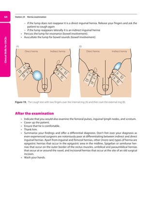 Clinical
Skills
for
OSCEs
64 Station 24 Hernia examination
–
– if the lump does not reappear it is a direct inguinal hernia. Release your fingers and ask the
patient to cough again
–
– if the lump reappears laterally it is an indirect inguinal hernia
• Percuss the lump for resonance (bowel involvement).
• Auscultate the lump for bowel sounds (bowel involvement).
Figure 19. The cough test with two fingers over the internal ring (A) and then over the external ring (B).
After the examination
• Indicate that you would also examine the femoral pulses, inguinal lymph nodes, and scrotum.
• Cover up the patient.
• Ensure that he is comfortable.
• Thank him.
• Summarise your findings and offer a differential diagnosis. Don’t fret over your diagnosis as
even experienced surgeons are notoriously poor at differentiating between indirect and direct
inguinal hernias. Apart from inguinal and femoral hernias, other (more rare) types of hernia are
epigastric hernias that occur in the epigastric area in the midline, Spigelian or semilunar her­
nias that occur on the outer border of the rectus muscles, umbilical and paraumbilical hernias
that occur at or around the navel, and incisional hernias that occur at the site of an old surgical
incision.
• Wash your hands.
Direct hernia
(A) (B)
Indirect hernia Direct hernia Indirect hernia
03-OCSEs-GI_Medicine_and_Urology_5e ccp.indd 64 19/03/2015 12:31
 