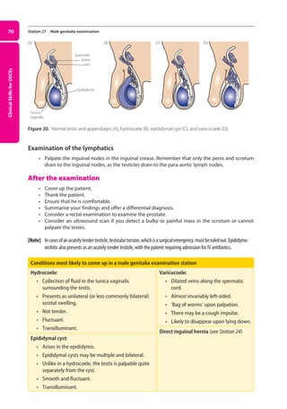 Clinical
Skills
for
OSCEs
70 Station 27 Male genitalia examination
Figure 20. Normal testis and appendages (A), hydrocoele (B), epididymal cyst (C), and varicocoele (D).
Examination of the lymphatics
• Palpate the inguinal nodes in the inguinal crease. Remember that only the penis and scrotum
drain to the inguinal nodes, as the testicles drain to the para-aortic lymph nodes.
After the examination
• Cover up the patient.
• Thank the patient.
• Ensure that he is comfortable.
• Summarise your findings and offer a differential diagnosis.
• Consider a rectal examination to examine the prostate.
• Consider an ultrasound scan if you detect a bulky or painful mass in the scrotum or cannot
palpate the testes.
[Note] Incasesofanacutelytendertesticle,testiculartorsion,whichisasurgicalemergency,mustberuledout.Epididymo-
orchitis also presents as an acutely tender testicle, with the patient requiring admission for IV antibiotics.
Conditions most likely to come up in a male genitalia examination station
Hydrocoele:
• collection of fluid in the tunica vaginalis
surrounding the testis.
• presents as unilateral (or less commonly bilateral)
scrotal swelling.
• not tender.
• fluctuant.
• transilluminant.
Epididymal cyst:
• arises in the epididymis.
• epididymal cysts may be multiple and bilateral.
• unlike in a hydrocoele, the testis is palpable quite
separately from the cyst.
• smooth and fluctuant.
• transilluminant.
Varicocoele:
• dilated veins along the spermatic
cord.
• almost invariably left-sided.
• ‘bag of worms’ upon palpation.
• there may be a cough impulse.
• likely to disappear upon lying down.
Direct inguinal hernia (see Station 24)
(B)
Spermatic
artery
vein
(A)
Epididymis
Tunica
vaginalis
(C) (D)
03-OCSEs-GI_Medicine_and_Urology_5e ccp.indd 70 19/03/2015 12:31
 