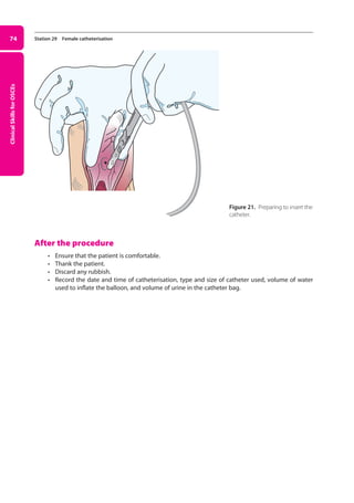 Clinical
Skills
for
OSCEs
74 Station 29 Female catheterisation
After the procedure
• Ensure that the patient is comfortable.
• Thank the patient.
• Discard any rubbish.
• Record the date and time of catheterisation, type and size of catheter used, volume of water
used to inflate the balloon, and volume of urine in the catheter bag.
Figure 21. Preparing to insert the
catheter.
03-OCSEs-GI_Medicine_and_Urology_5e ccp.indd 74 19/03/2015 12:31
 