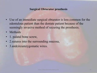 Surgical Obturator prosthesis
• Use of an immediate surgical obturator is less common for the
edentulous patient than the ...