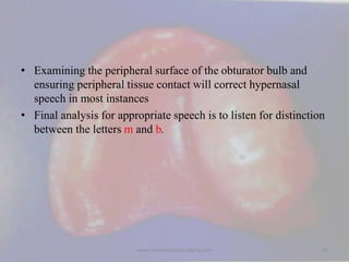 • Examining the peripheral surface of the obturator bulb and
ensuring peripheral tissue contact will correct hypernasal
sp...