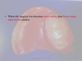 • When the' surgical site becomes more stable, then fewer major
adjustments needed
55www.indiandentalacademy.com
 