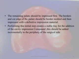• The remaining palate should be impressed first. The borders
and cut edge of the palate should be border molded and then
...