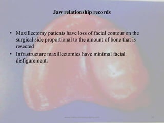 Jaw relationship records
• Maxillectomy patients have loss of facial contour on the
surgical side proportional to the amou...