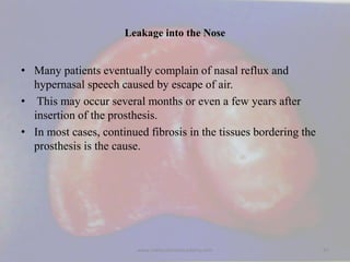 Leakage into the Nose
• Many patients eventually complain of nasal reflux and
hypernasal speech caused by escape of air.
•...