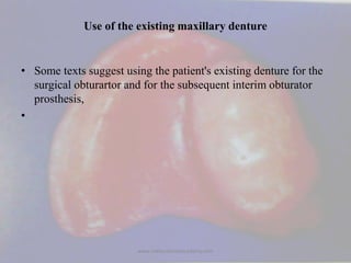 Use of the existing maxillary denture
• Some texts suggest using the patient's existing denture for the
surgical obturarto...