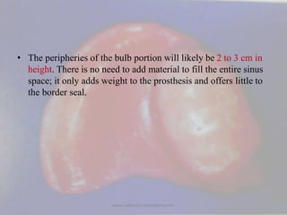 • The peripheries of the bulb portion will likely be 2 to 3 cm in
height. There is no need to add material to fill the ent...