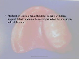 • Mastication is also often difficult for patients with large
surgical defects and must be accomplished on the nonsurgery
...
