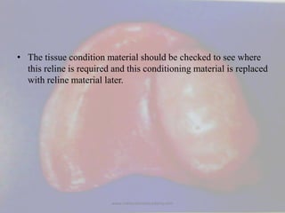 • The tissue condition material should be checked to see where
this reline is required and this conditioning material is r...