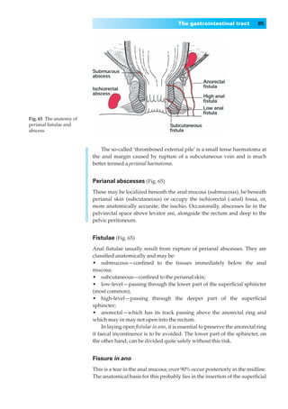 The gastrointestinal tract            85




Fig. 65◊The anatomy of
perianal ﬁstulae and
abscess.



                             The so-called ‘thrombosed external pile’ is a small tense haematoma at
                         the anal margin caused by rupture of a subcutaneous vein and is much
                         better termed a perianal haematoma.


                         Perianal abscesses (Fig. 65)
                         These may be localized beneath the anal mucosa (submucous), be beneath
                         perianal skin (subcutaneous) or occupy the ischiorectal (-anal) fossa, or,
                         more anatomically accurate, the isschio. Occasionally, abscesses lie in the
                         pelvirectal space above levator ani, alongside the rectum and deep to the
                         pelvic peritoneum.


                         Fistulae (Fig. 65)
                         Anal ﬁstulae usually result from rupture of perianal abscesses. They are
                         classiﬁed anatomically and may be:
                         •◊◊submucous — conﬁned to the tissues immediately below the anal
                         mucosa;
                         •◊◊subcutaneous—conﬁned to the perianal skin;
                         •◊◊low-level — passing through the lower part of the superﬁcial sphincter
                         (most common);
                         •◊◊high-level — passing through the deeper part of the superﬁcial
                         sphincter;
                         •◊◊anorectal — which has its track passing above the anorectal ring and
                         which may or may not open into the rectum.
                              In laying open ﬁstulae in ano, it is essential to preserve the anorectal ring
                         if faecal incontinence is to be avoided. The lower part of the sphincter, on
                         the other hand, can be divided quite safely without this risk.


                         Fissure in ano
                         This is a tear in the anal mucosa; over 90% occur posteriorly in the midline.
                         The anatomical basis for this probably lies in the insertion of the superﬁcial
 