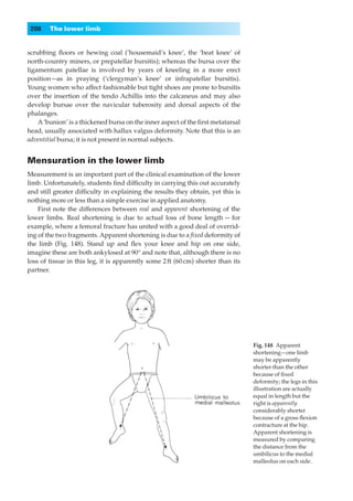 208    The lower limb


scrubbing ﬂoors or hewing coal (‘housemaid’s knee’, the ‘beat knee’ of
north-country miners, or prepatellar bursitis); whereas the bursa over the
ligamentum patellae is involved by years of kneeling in a more erect
position —as in praying (‘clergyman’s knee’ or infrapatellar bursitis).
Young women who affect fashionable but tight shoes are prone to bursitis
over the insertion of the tendo Achillis into the calcaneus and may also
develop bursae over the navicular tuberosity and dorsal aspects of the
phalanges.
    A ‘bunion’ is a thickened bursa on the inner aspect of the ﬁrst metatarsal
head, usually associated with hallux valgus deformity. Note that this is an
adventitial bursa; it is not present in normal subjects.


Mensuration in the lower limb
Measurement is an important part of the clinical examination of the lower
limb. Unfortunately, students ﬁnd difﬁculty in carrying this out accurately
and still greater difﬁculty in explaining the results they obtain, yet this is
nothing more or less than a simple exercise in applied anatomy.
    First note the differences between real and apparent shortening of the
lower limbs. Real shortening is due to actual loss of bone length — for
example, where a femoral fracture has united with a good deal of overrid-
ing of the two fragments. Apparent shortening is due to a ﬁxed deformity of
the limb (Fig. 148). Stand up and ﬂex your knee and hip on one side,
imagine these are both ankylosed at 90° and note that, although there is no
loss of tissue in this leg, it is apparently some 2 ft (60 cm) shorter than its
partner.




                                                                                  Fig. 148◊Apparent
                                                                                  shortening—one limb
                                                                                  may be apparently
                                                                                  shorter than the other
                                                                                  because of ﬁxed
                                                                                  deformity; the legs in this
                                                                                  illustration are actually
                                                                                  equal in length but the
                                                                                  right is apparently
                                                                                  considerably shorter
                                                                                  because of a gross ﬂexion
                                                                                  contracture at the hip.
                                                                                  Apparent shortening is
                                                                                  measured by comparing
                                                                                  the distance from the
                                                                                  umbilicus to the medial
                                                                                  malleolus on each side.
 