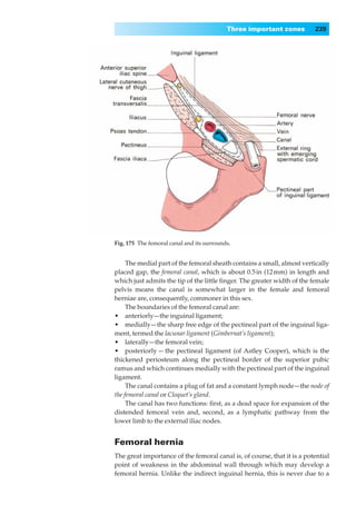Three important zones         239




Fig. 175◊The femoral canal and its surrounds.


     The medial part of the femoral sheath contains a small, almost vertically
placed gap, the femoral canal, which is about 0.5 in (12 mm) in length and
which just admits the tip of the little ﬁnger. The greater width of the female
pelvis means the canal is somewhat larger in the female and femoral
herniae are, consequently, commoner in this sex.
     The boundaries of the femoral canal are:
•◊◊anteriorly—the inguinal ligament;
•◊◊medially— the sharp free edge of the pectineal part of the inguinal liga-
ment, termed the lacunar ligament (Gimbernat’s ligament);
•◊◊laterally—the femoral vein;
•◊◊posteriorly — the pectineal ligament (of Astley Cooper), which is the
thickened periosteum along the pectineal border of the superior pubic
ramus and which continues medially with the pectineal part of the inguinal
ligament.
     The canal contains a plug of fat and a constant lymph node— the node of
the femoral canal or Cloquet’s gland.
     The canal has two functions: ﬁrst, as a dead space for expansion of the
distended femoral vein and, second, as a lymphatic pathway from the
lower limb to the external iliac nodes.


Femoral hernia
The great importance of the femoral canal is, of course, that it is a potential
point of weakness in the abdominal wall through which may develop a
femoral hernia. Unlike the indirect inguinal hernia, this is never due to a
 