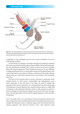 240    The lower limb




Fig. 176◊The relationship of an indirect inguinal and a femoral hernia to the pubic
tubercle; the inguinal hernia emerges above and medial to the tubercle, the femoral
hernia lies below and lateral to it.


congenital sac and, although cases do occur rarely in children, it is never
found in the newborn.
    As the hernia sac enlarges, it emerges through the saphenous opening
then turns upwards along the pathway presented by the superﬁcial epigas-
tric and superﬁcial circumﬂex iliac vessels so that it may come to project
above the inguinal ligament. There should not, however, be any difﬁculty
in differentiating between an irreducible femoral and inguinal hernia; the
neck of the former must always lie below and lateral to the pubic tubercle
whereas the sac of the latter extends above and medial to this landmark
(Fig. 176).
    The neck of the femoral canal is narrow and bears a particular sharp
medial border; for this reason, irreducibility and strangulation occur
more commonly at this site than at any other. In order to enlarge the
opening of the canal at operation on a strangulated case, this sharp edge
of Gimbernat’s lacunar ligament may require incision; there is a slight risk
of damage to the abnormal obturator artery in this manoeuvre and it is
safer to enlarge the opening by making several small nicks into the liga-
ment. The safe alternative is to divide the inguinal ligament, which can then
be repaired.

Note.◊Normally there is an anastomosis between the pubic branch of the
inferior epigastric artery and the pubic branch of the obturator artery. Occa-
sionally the obturator artery is entirely replaced by this branch from the
inferior epigastric — the abnormal obturator artery. This aberrant vessel
 
