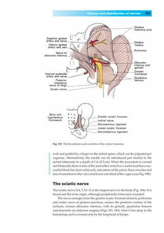 Course and distribution of nerves               253




Fig. 183◊The boundaries and contents of the sciatic foramina.


wall and guided by a ﬁnger to the ischial spine, which can be palpated per
vaginam. Alternatively, the needle can be introduced just medial to the
ischial tuberosity to a depth of 1 in (2.5 cm). When the procedure is carried
out bilaterally there is loss of the anal reﬂex (which is a useful test that a suc-
cessful block has been achieved), relaxation of the pelvic ﬂoor muscles and
loss of sensation to the vulva and lower one third of the vagina (see Fig. 99b).


The sciatic nerve
The sciatic nerve (L4, 5, S1–3) is the largest nerve in the body (Fig. 184). It is
broad and ﬂat at its origin, although peripherally it becomes rounded.
    The nerve emerges from the greater sciatic foramen distal to piriformis
and under cover of gluteus maximus, crosses the posterior surface of the
ischium, crosses obturator internus, with its gemelli, quadratus femoris
and descends on adductor magnus (Figs 183, 184). Here it lies deep to the
hamstrings and is crossed only by the long head of biceps.
 