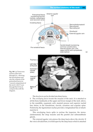 The surface anatomy of the neck                263


                                                    Anterior jugular
                               Pretracheal fascia
                                                         vein
                             (containing thyroid,
                           trachea, oesophagus
                           and recurrent nerve)
                           Investing fascia
                                                                                   Sternocleidomastoid
                                                                                   Sternohyoid
                                                                                   Sternothyroid

                                                                                   Omohyoid
                                                                                   External jugular vein




                                                       C6              Carotid sheath (containing
                            Pre-vertebral fascia                       common carotid artery,
                                                                       internal jugular vein, and
                                                                       vagus nerve) with sympathetic
                                                                       chain behind                          (a)




Fig. 188◊(a) Transverse
section of the neck
through C6—showing
the fascial planes and
also the contents of the
pretracheal fascia (or
‘visceral compartment of
the neck’). (b) CT scan
through the C6 level;
compare this with the
diagram.                                                                                           (b)


                                The deep fascia can be divided into three layers.
                           1◊◊The enveloping fascia invests the muscles of the neck. It is attached to
                           all the bony landmarks at the upper and lower margin of the neck: above,
                           to the mandible, zygomatic arch, mastoid process and superior nuchal
                           line; below, to the manubrium, clavicle, acromion and scapular spine.
                           Posteriorly, the ligamentum nuchae provides a longitudinal line of attach-
                           ment for it.
                                This enveloping fascia splits to enclose the trapezius, the sterno-
                           cleidomastoid, the strap muscles and the parotid and submandibular
                           glands.
                                The external jugular vein pierces the deep fascia above the clavicle. If
                           the vein is divided here, it is held open by the deep fascia which is attached
 