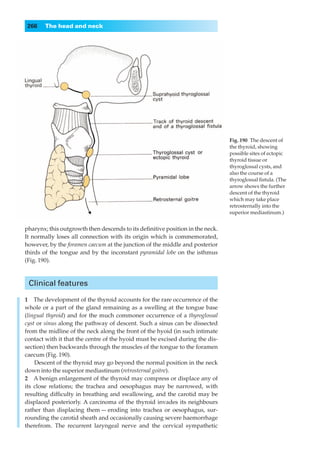 266    The head and neck




                                                                               Fig. 190◊The descent of
                                                                               the thyroid, showing
                                                                               possible sites of ectopic
                                                                               thyroid tissue or
                                                                               thyroglossal cysts, and
                                                                               also the course of a
                                                                               thyroglossal ﬁstula. (The
                                                                               arrow shows the further
                                                                               descent of the thyroid
                                                                               which may take place
                                                                               retrosternally into the
                                                                               superior mediastinum.)


pharynx; this outgrowth then descends to its deﬁnitive position in the neck.
It normally loses all connection with its origin which is commemorated,
however, by the foramen caecum at the junction of the middle and posterior
thirds of the tongue and by the inconstant pyramidal lobe on the isthmus
(Fig. 190).



 Clinical features

1◊◊The development of the thyroid accounts for the rare occurrence of the
whole or a part of the gland remaining as a swelling at the tongue base
(lingual thyroid) and for the much commoner occurrence of a thyroglossal
cyst or sinus along the pathway of descent. Such a sinus can be dissected
from the midline of the neck along the front of the hyoid (in such intimate
contact with it that the centre of the hyoid must be excised during the dis-
section) then backwards through the muscles of the tongue to the foramen
caecum (Fig. 190).
    Descent of the thyroid may go beyond the normal position in the neck
down into the superior mediastinum (retrosternal goitre).
2◊◊A benign enlargement of the thyroid may compress or displace any of
its close relations; the trachea and oesophagus may be narrowed, with
resulting difﬁculty in breathing and swallowing, and the carotid may be
displaced posteriorly. A carcinoma of the thyroid invades its neighbours
rather than displacing them — eroding into trachea or oesophagus, sur-
rounding the carotid sheath and occasionally causing severe haemorrhage
therefrom. The recurrent laryngeal nerve and the cervical sympathetic
 