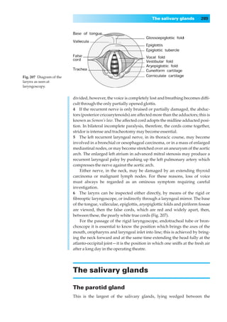 The salivary glands          289




Fig. 207◊Diagram of the
larynx as seen at
laryngoscopy.


                          divided, however, the voice is completely lost and breathing becomes difﬁ-
                          cult through the only partially opened glottis.
                          4◊◊If the recurrent nerve is only bruised or partially damaged, the abduc-
                          tors (posterior cricoarytenoids) are affected more than the adductors; this is
                          known as Semon’s law. The affected cord adopts the midline adducted posi-
                          tion. In bilateral incomplete paralysis, therefore, the cords come together,
                          stridor is intense and tracheotomy may become essential.
                          5◊◊The left recurrent laryngeal nerve, in its thoracic course, may become
                          involved in a bronchial or oesophageal carcinoma, or in a mass of enlarged
                          mediastinal nodes, or may become stretched over an aneurysm of the aortic
                          arch. The enlarged left atrium in advanced mitral stenosis may produce a
                          recurrent laryngeal palsy by pushing up the left pulmonary artery which
                          compresses the nerve against the aortic arch.
                              Either nerve, in the neck, may be damaged by an extending thyroid
                          carcinoma or malignant lymph nodes. For these reasons, loss of voice
                          must always be regarded as an ominous symptom requiring careful
                          investigation.
                          6◊◊The larynx can be inspected either directly, by means of the rigid or
                          ﬁbreoptic laryngoscope, or indirectly through a laryngeal mirror. The base
                          of the tongue, valleculae, epiglottis, aryepiglottic folds and piriform fossae
                          are viewed, then the false cords, which are red and widely apart, then,
                          between these, the pearly white true cords (Fig. 207).
                              For the passage of the rigid laryngoscope, endotracheal tube or bron-
                          choscope it is essential to know the position which brings the axes of the
                          mouth, oropharynx and laryngeal inlet into line; this is achieved by bring-
                          ing the neck forward and at the same time extending the head fully at the
                          atlanto-occipital joint — it is the position in which one sniffs at the fresh air
                          after a long day in the operating theatre.




                          The salivary glands

                          The parotid gland
                          This is the largest of the salivary glands, lying wedged between the
 