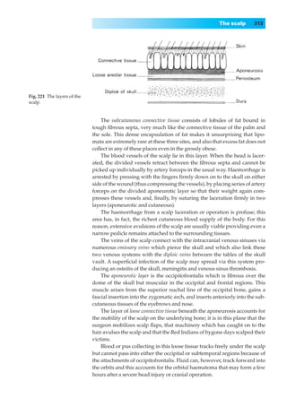The scalp       313




Fig. 221◊The layers of the
scalp.


                                 The subcutaneous connective tissue consists of lobules of fat bound in
                             tough ﬁbrous septa, very much like the connective tissue of the palm and
                             the sole. This dense encapsulation of fat makes it unsurprising that lipo-
                             mata are extremely rare at these three sites, and also that excess fat does not
                             collect in any of these places even in the grossly obese.
                                 The blood vessels of the scalp lie in this layer. When the head is lacer-
                             ated, the divided vessels retract between the ﬁbrous septa and cannot be
                             picked up individually by artery forceps in the usual way. Haemorrhage is
                             arrested by pressing with the ﬁngers ﬁrmly down on to the skull on either
                             side of the wound (thus compressing the vessels), by placing series of artery
                             forceps on the divided aponeurotic layer so that their weight again com-
                             presses these vessels and, ﬁnally, by suturing the laceration ﬁrmly in two
                             layers (aponeurotic and cutaneous).
                                 The haemorrhage from a scalp laceration or operation is profuse; this
                             area has, in fact, the richest cutaneous blood supply of the body. For this
                             reason, extensive avulsions of the scalp are usually viable providing even a
                             narrow pedicle remains attached to the surrounding tissues.
                                 The veins of the scalp connect with the intracranial venous sinuses via
                             numerous emissary veins which pierce the skull and which also link these
                             two venous systems with the diploic veins between the tables of the skull
                             vault. A superﬁcial infection of the scalp may spread via this system pro-
                             ducing an osteitis of the skull, meningitis and venous sinus thrombosis.
                                 The aponeurotic layer is the occipitofrontalis which is ﬁbrous over the
                             dome of the skull but muscular in the occipital and frontal regions. This
                             muscle arises from the superior nuchal line of the occipital bone, gains a
                             fascial insertion into the zygomatic arch, and inserts anteriorly into the sub-
                             cutaneous tissues of the eyebrows and nose.
                                 The layer of loose connective tissue beneath the aponeurosis accounts for
                             the mobility of the scalp on the underlying bone; it is in this plane that the
                             surgeon mobilizes scalp ﬂaps, that machinery which has caught on to the
                             hair avulses the scalp and that the Red Indians of bygone days scalped their
                             victims.
                                 Blood or pus collecting in this loose tissue tracks freely under the scalp
                             but cannot pass into either the occipital or subtemporal regions because of
                             the attachments of occipitofrontalis. Fluid can, however, track forward into
                             the orbits and this accounts for the orbital haematoma that may form a few
                             hours after a severe head injury or cranial operation.
 