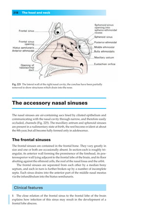 318     The head and neck




Fig. 225◊The lateral wall of the right nasal cavity; the conchae have been partially
removed to show structures which drain into the nose.




The accessory nasal sinuses

The nasal sinuses are air-containing sacs lined by ciliated epithelium and
communicating with the nasal cavity through narrow, and therefore easily
occluded, channels (Fig. 225). The maxillary antrum and sphenoid sinuses
are present in a rudimentary state at birth, the rest become evident at about
the 8th year, but all become fully formed only in adolescence.


The frontal sinuses
The frontal sinuses are contained in the frontal bone. They vary greatly in
size and one or both are occasionally absent. In section each is roughly tri-
angular, its anterior wall forming the prominence of the forehead, its pos-
terosuperior wall lying adjacent to the frontal lobe of the brain, and its ﬂoor
abutting against the ethmoid cells, the roof of the nasal fossa and the orbit.
    The frontal sinuses are separated from each other by a median bony
septum, and each in turn is further broken up by a number of incomplete
septa. Each sinus drains into the anterior part of the middle nasal meatus
via the infundibulum into the hiatus semilunaris.



 Clinical features

1◊◊The close relation of the frontal sinus to the frontal lobe of the brain
explains how infection of this sinus may result in the development of a
frontal lobe abscess.
 