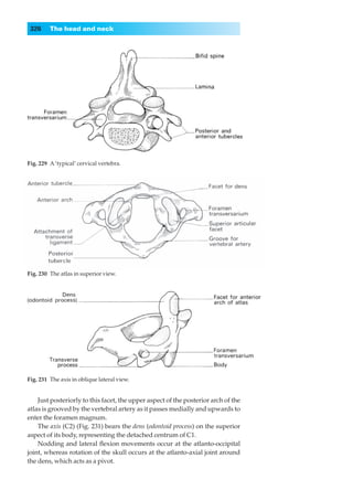 326     The head and neck




Fig. 229◊A ‘typical’ cervical vertebra.




Fig. 230◊The atlas in superior view.




Fig. 231◊The axis in oblique lateral view.


    Just posteriorly to this facet, the upper aspect of the posterior arch of the
atlas is grooved by the vertebral artery as it passes medially and upwards to
enter the foramen magnum.
    The axis (C2) (Fig. 231) bears the dens (odontoid process) on the superior
aspect of its body, representing the detached centrum of C1.
    Nodding and lateral ﬂexion movements occur at the atlanto-occipital
joint, whereas rotation of the skull occurs at the atlanto-axial joint around
the dens, which acts as a pivot.
 