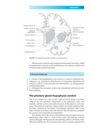 The brain   347




Fig. 246◊The thalamus and 3rd ventricle in coronal section.


    The hormones oxytocin and vasopressin (anti-diuretic hormone, ADH)
are produced by neurones in the hypothalamus and released at their axon
terminals in the posterior pituitary.



 Clinical features

1◊◊Lesions of the hypothalamus may result in a variety of autonomic dis-
turbances, e.g. somnolence, disturbances of temperature regulation and
obesity, as well as a variety of endocrine abnormalities, e.g. hypogonadism
and hypothyroidism.
2◊◊Damage to the supraoptic nuclei or the infundibular stalk leads to dia-
betes insipidus.


The pituitary gland (hypophysis cerebri)
This is an example of a ‘two in one’ organ of which nature is so keen;
compare the two glandular components of the suprarenal cortex and
medulla, and the exocrine and endocrine parts of the pancreas, testis and
ovary. The pituitary comprises a larger anterior and smaller posterior lobe,
the latter connected by the hollow infundibulum (pituitary stalk) to the
tuber cinereum in the ﬂoor of the 3rd ventricle. The two lobes are connected
by a narrow zone termed the pars intermedia.
    The pituitary lies in the cavity of the pituitary fossa covered over by the
diaphragma sellae, which is a fold of dura mater. This fold has a central
aperture through which passes the infundibulum. Below is the body of the
sphenoid, laterally lies the cavernous sinus and its contents separated by
 