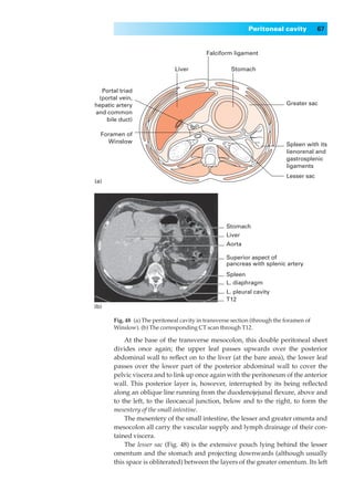 Peritoneal cavity           67


                                            Falciform ligament

                               Liver                  Stomach


  Portal triad
 (portal vein,
hepatic artery                                                              Greater sac
and common
    bile duct)

  Foramen of
    Winslow
                                                                            Spleen with its
                                                                            lienorenal and
                                                                            gastrosplenic
                                                                            ligaments
                                                                            Lesser sac
(a)




                                                    Stomach
                                                    Liver
                                                    Aorta

                                                    Superior aspect of
                                                    pancreas with splenic artery
                                                    Spleen
                                                    L. diaphragm
                                                    L. pleural cavity
                                                    T12
(b)

       Fig. 48◊(a) The peritoneal cavity in transverse section (through the foramen of
       Winslow). (b) The corresponding CT scan through T12.

           At the base of the transverse mesocolon, this double peritoneal sheet
       divides once again; the upper leaf passes upwards over the posterior
       abdominal wall to reﬂect on to the liver (at the bare area), the lower leaf
       passes over the lower part of the posterior abdominal wall to cover the
       pelvic viscera and to link up once again with the peritoneum of the anterior
       wall. This posterior layer is, however, interrupted by its being reﬂected
       along an oblique line running from the duodenojejunal ﬂexure, above and
       to the left, to the ileocaecal junction, below and to the right, to form the
       mesentery of the small intestine.
           The mesentery of the small intestine, the lesser and greater omenta and
       mesocolon all carry the vascular supply and lymph drainage of their con-
       tained viscera.
           The lesser sac (Fig. 48) is the extensive pouch lying behind the lesser
       omentum and the stomach and projecting downwards (although usually
       this space is obliterated) between the layers of the greater omentum. Its left
 
