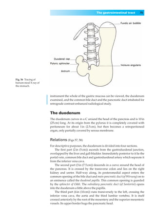The gastrointestinal tract          75




Fig. 56◊Tracing of
barium meal X-ray of
the stomach.


                       instrument the whole of the gastric mucosa can be viewed, the duodenum
                       examined, and the common bile duct and the pancreatic duct intubated for
                       retrograde contrast-enhanced radiological study.


                       The duodenum
                       The duodenum curves in a C around the head of the pancreas and is 10 in
                       (25 cm) long. At its origin from the pylorus it is completely covered with
                       peritoneum for about 1 in (2.5 cm), but then becomes a retroperitoneal
                       organ, only partially covered by serous membrane.


                       Relations (Figs 57, 58)
                       For descriptive purposes, the duodenum is divided into four sections.
                           The ﬁrst part (2 in (5 cm)) ascends from the gastroduodenal junction,
                       overlapped by the liver and gall-bladder. Immediately posterior to it lie the
                       portal vein, common bile duct and gastroduodenal artery which separate it
                       from the inferior vena cava.
                           The second part (3 in (7.5 cm)) descends in a curve around the head of
                       the pancreas. It is crossed by the transverse colon and lies on the right
                       kidney and ureter. Half-way along, its posteromedial aspect enters the
                       common opening of the bile duct and main pancreatic duct (of Wirsung) on to
                       an eminence called the duodenal papilla. This common opening is guarded
                       by the sphincter of Oddi. The subsidiary pancreatic duct (of Santorini) opens
                       into the duodenum a little above the papilla.
                           The third part (4 in (10 cm)) runs transversely to the left, crossing the
                       inferior vena cava, the aorta and the third lumbar vertebra. It is itself
                       crossed anteriorly by the root of the mesentery and the superior mesenteric
                       vessels. Its upper border hugs the pancreatic head.
 