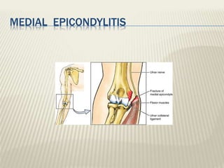 Clinical anatomy of elbow