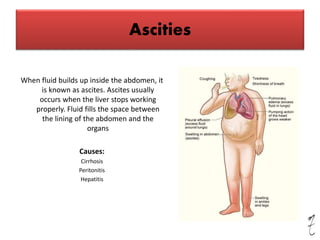 Ascities
When fluid builds up inside the abdomen, it
is known as ascites. Ascites usually
occurs when the liver stops working
properly. Fluid fills the space between
the lining of the abdomen and the
organs
Causes:
Cirrhosis
Peritonitis
Hepatitis
 