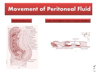 Movement of Peritoneal Fluid
Peritoneal Barriers Lower And Highest Areas In Supine Position
 