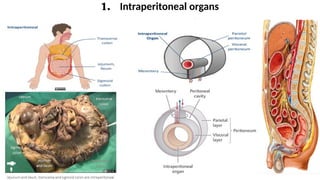 Define Intraperitoneal CLINICAL ANATOMY OF THE PERITONEUM PowerPoint Presentation | PPTX